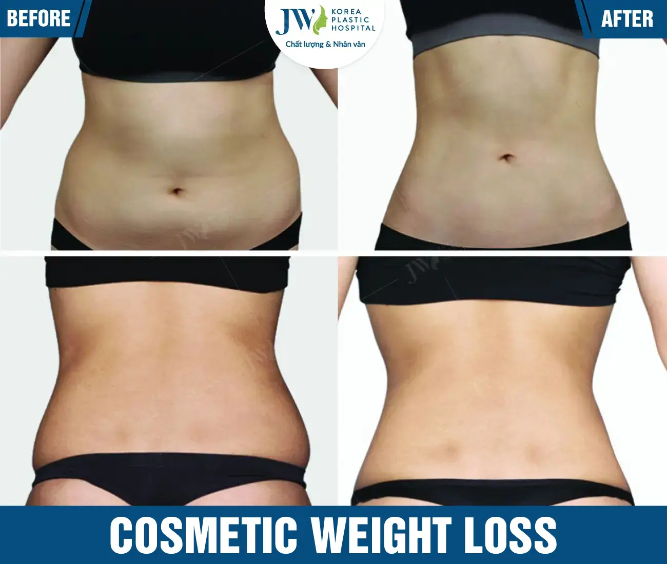 Cosmetic weight loss